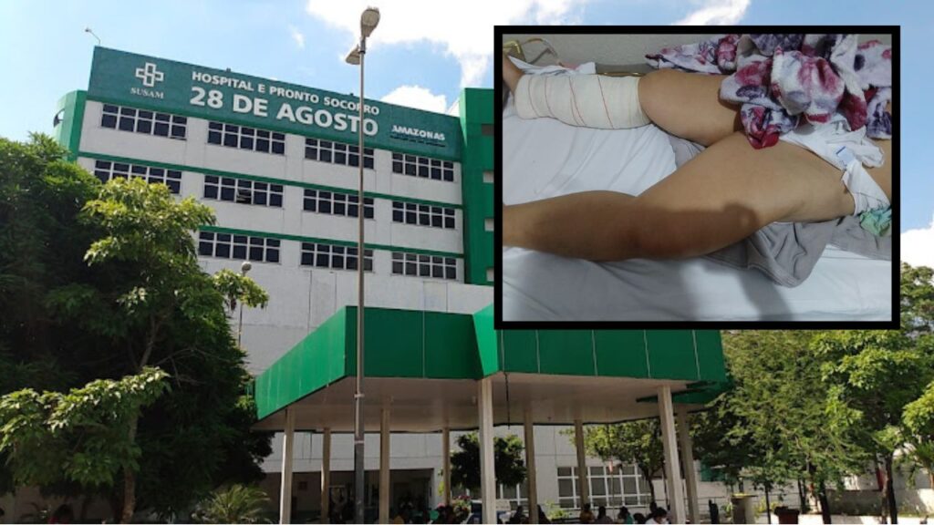 Hospital 28 de Agosto libera mulher operada
