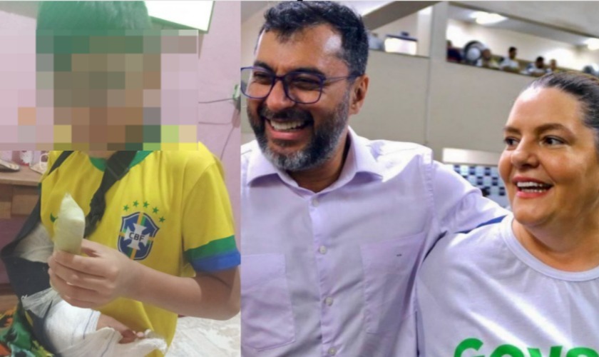 Falência da Saúde no Amazonas: SES não  consegue fazer nem curativo em criança