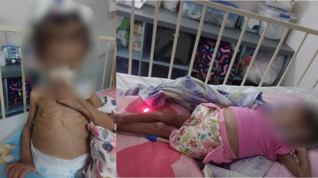 Criança morre após um ano de espera e descaso no Hospital da Criança da Zona Sul