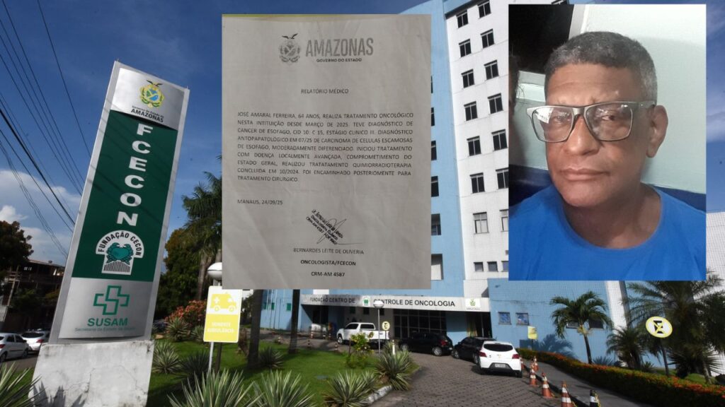 Esperando há quase dois anos, paciente com câncer de esôfago enfrenta falta de respostas na FCecon